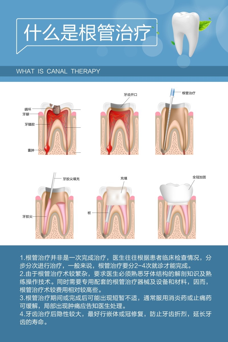 牙科装饰画根管治疗