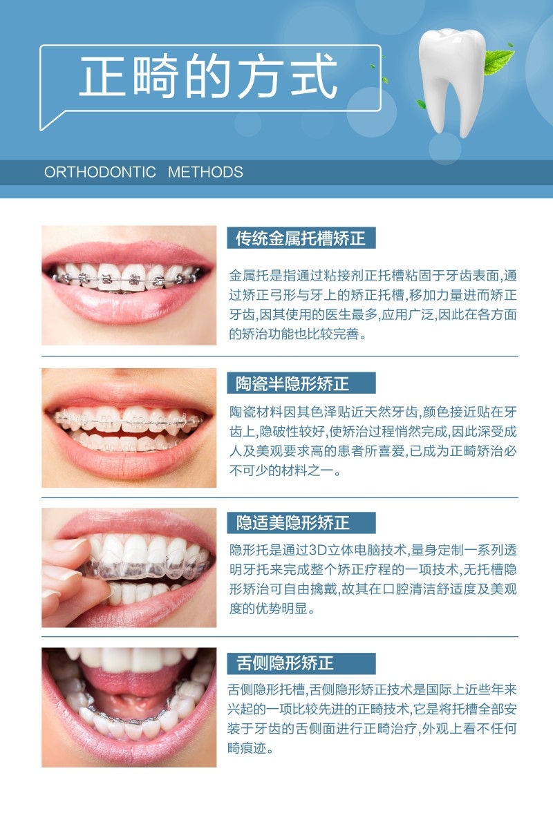 牙科装饰画正畸的方式