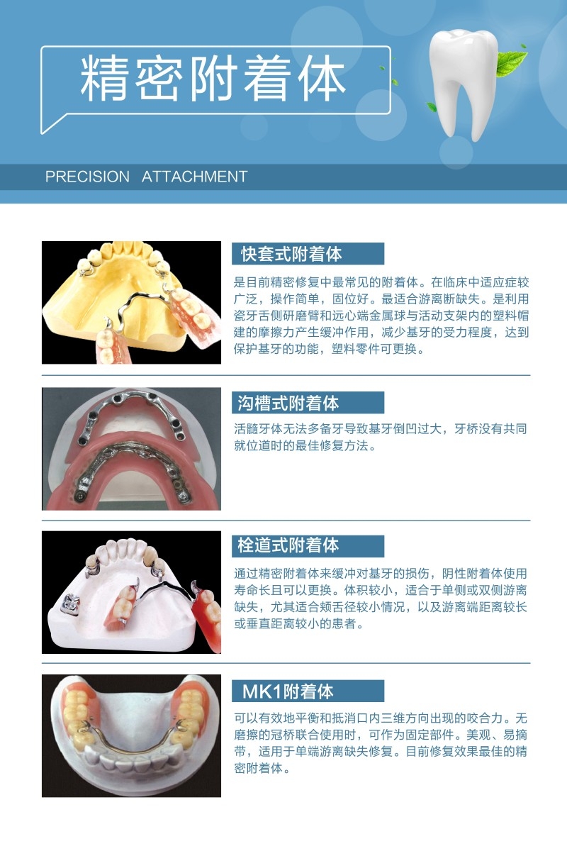 牙科装饰画精密附着体