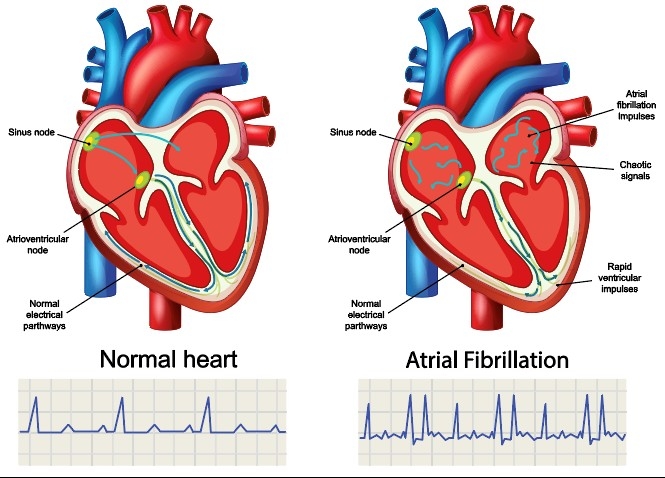 心脏矢量素材挂画 (3)